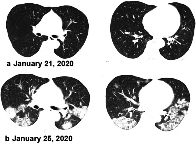 Fig. 5