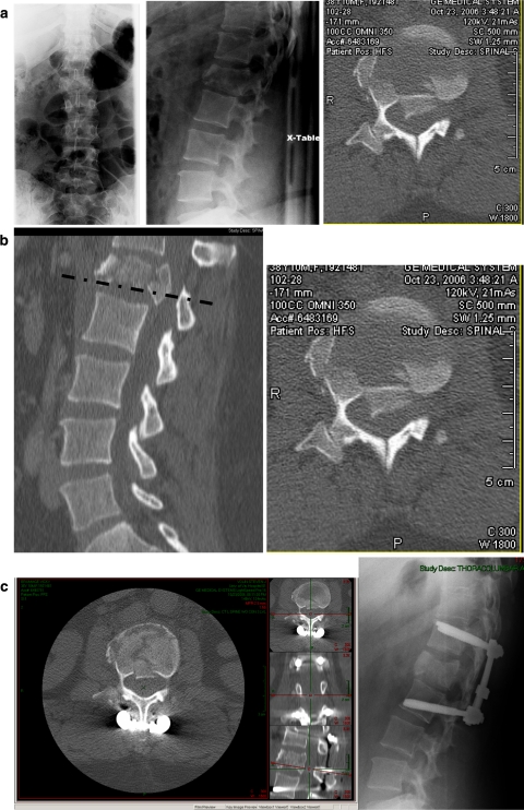 Fig. 3