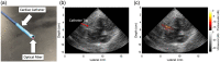 Fig. 16