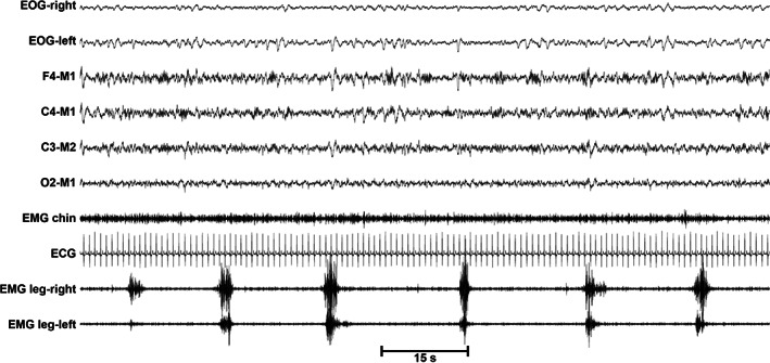 FIGURE 2