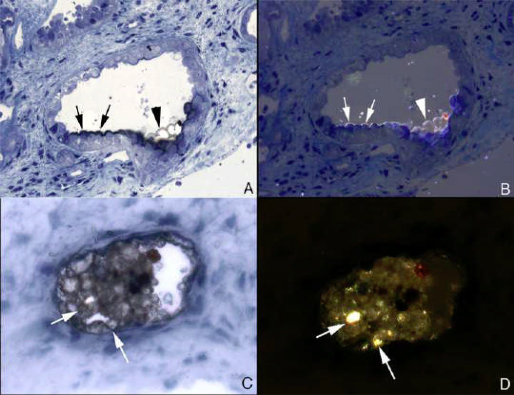 Figure 17