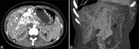Figure 3(a and b)