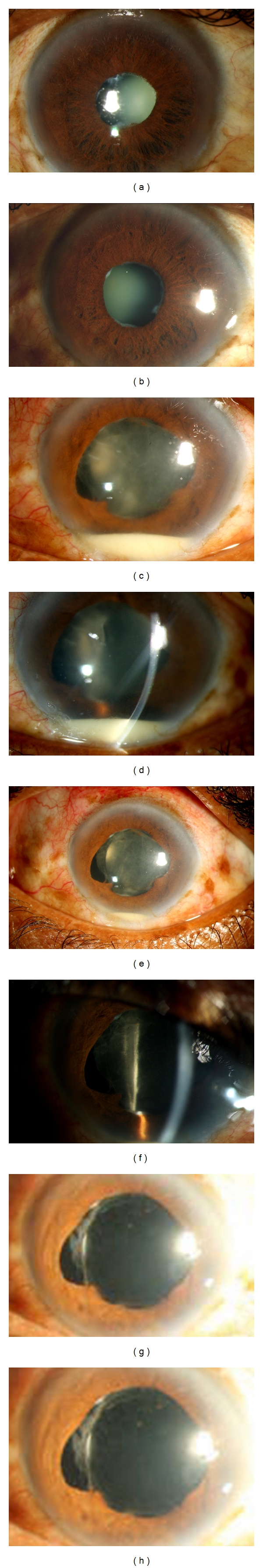 Figure 11