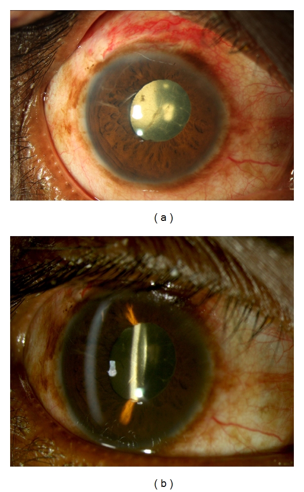 Figure 12