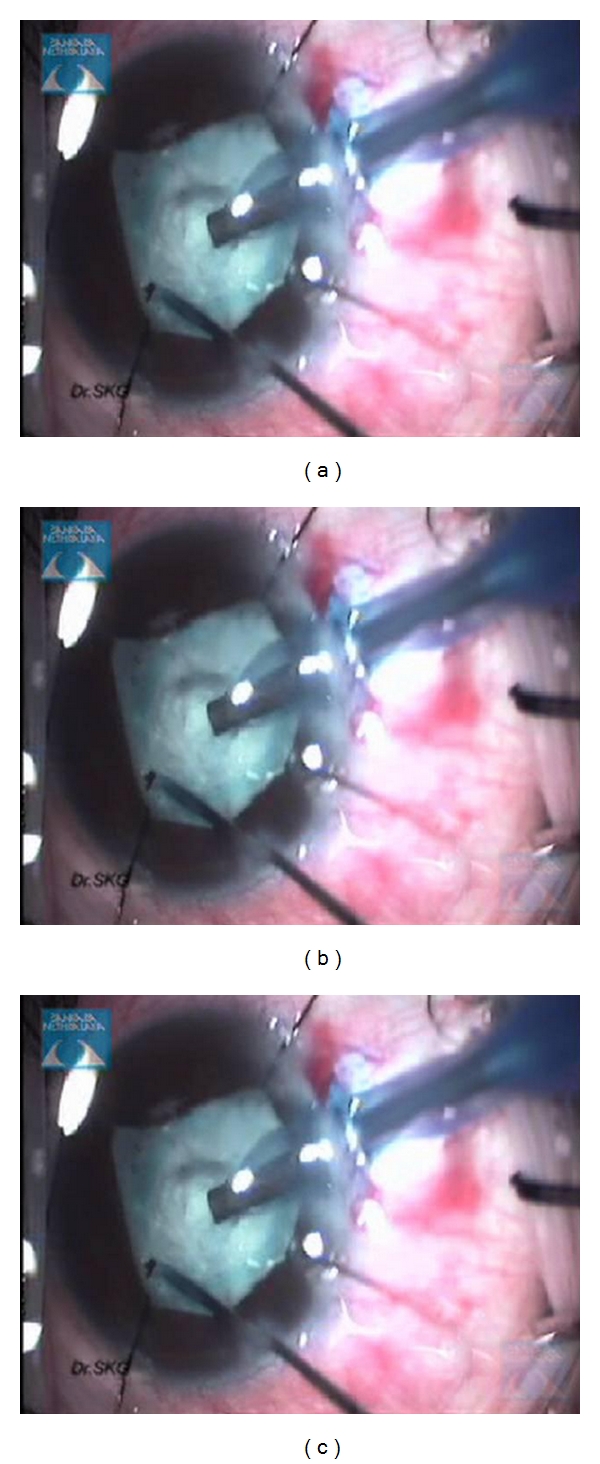 Figure 9