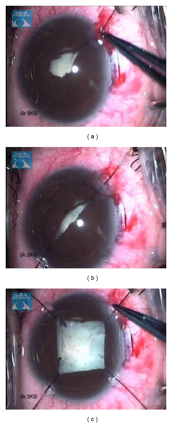 Figure 6