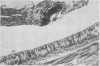 362