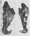 357
