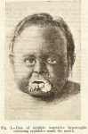 302