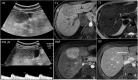 Fig. 10