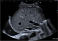 Fig. 12