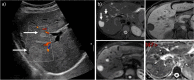 Fig. 11
