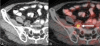 Figure 5 (A,B)
