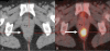 Figure 3 (A,B)