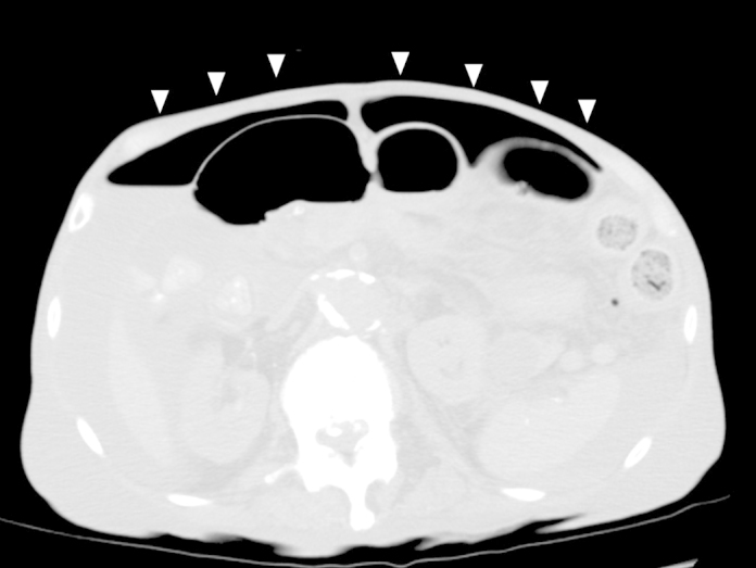 Fig. 2