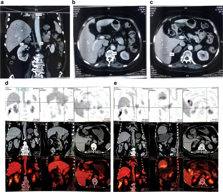 Fig. 1