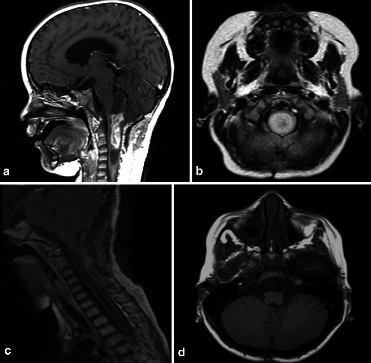 Fig. 21