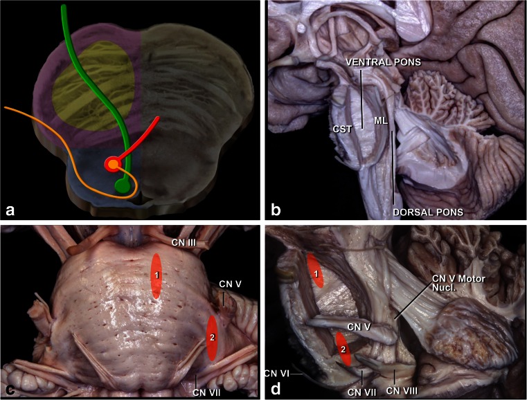 Fig. 12