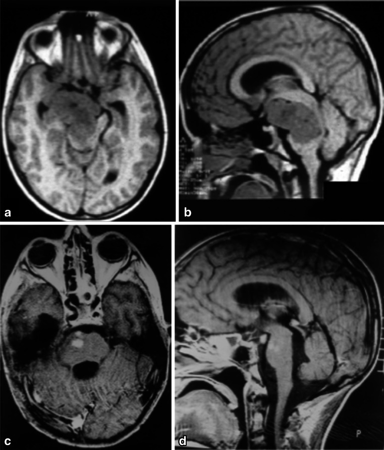 Fig. 15