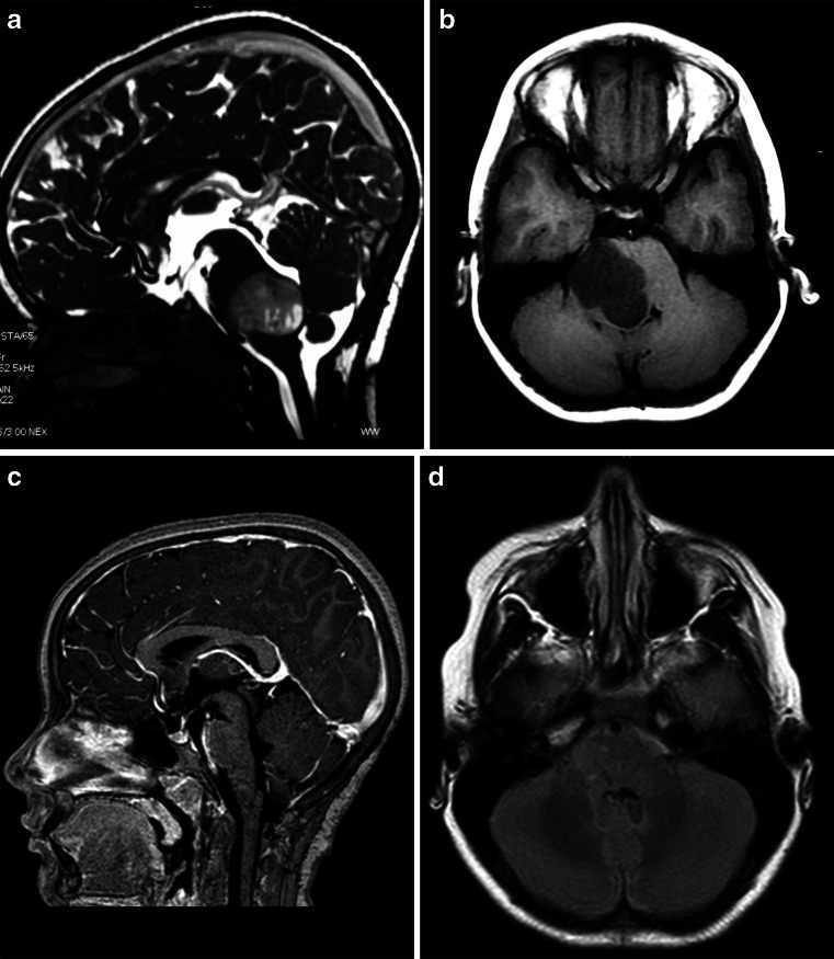 Fig. 18