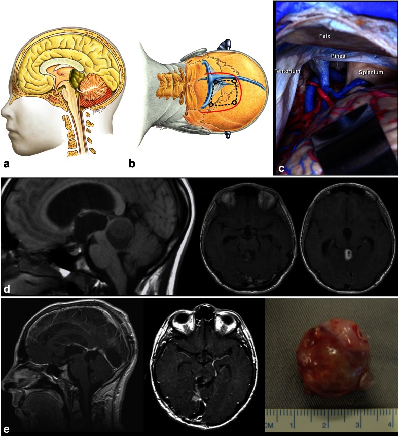 Fig. 10