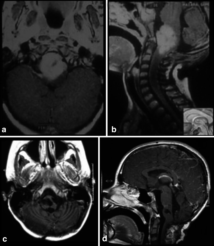 Fig. 20