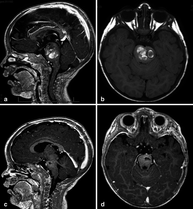 Fig. 14