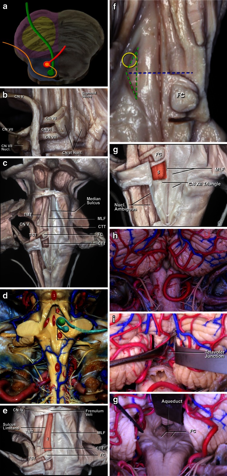 Fig. 16