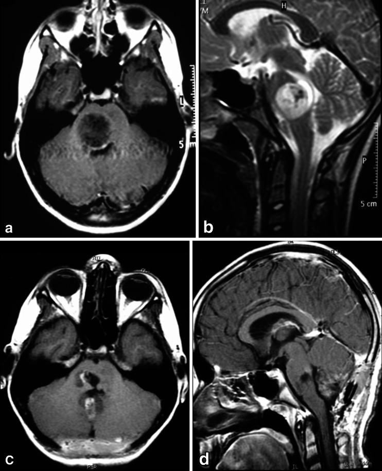 Fig. 17