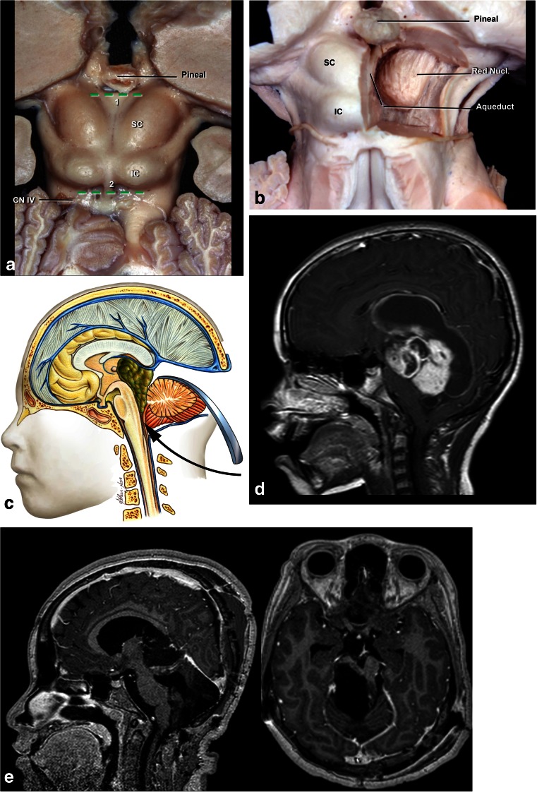 Fig. 11