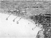 156-2