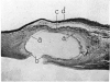 158-4