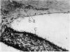 156-4