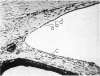 156-2
