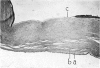 158-1