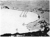 156-3
