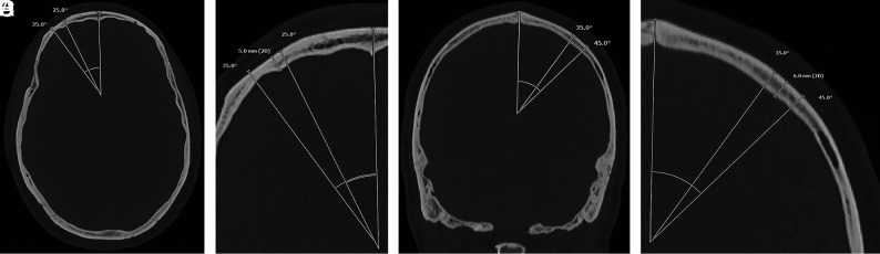 FIG 3.