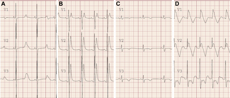 Figure 14