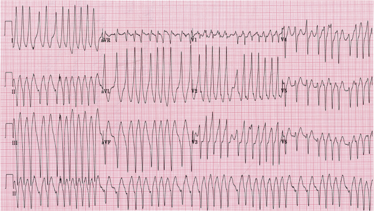 Figure 5