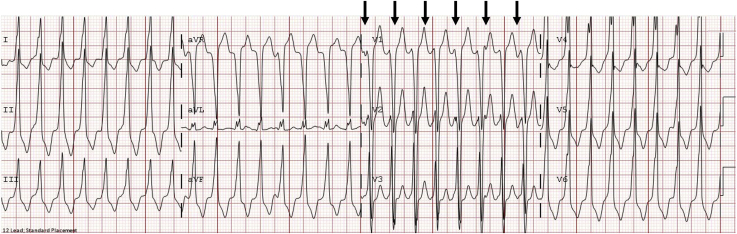 Figure 6