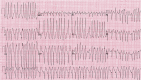 Figure 5
