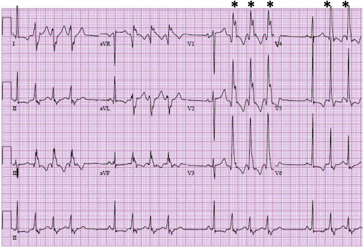 Figure 11