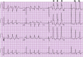 Figure 11