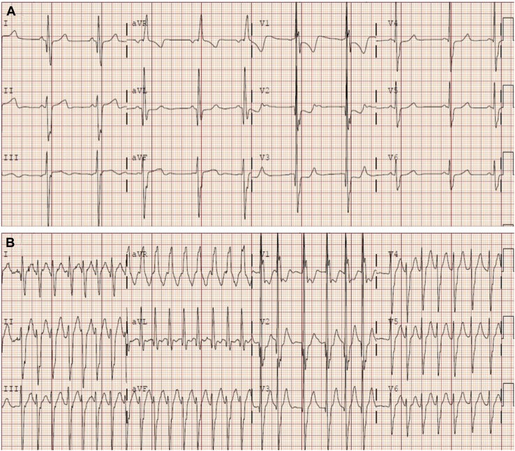 Figure 3