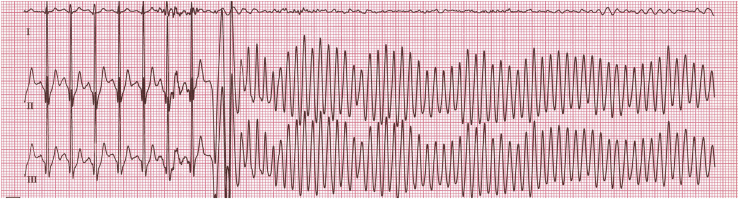 Figure 9