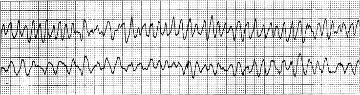 Figure 10