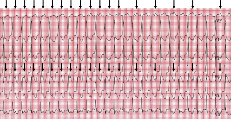 Figure 13