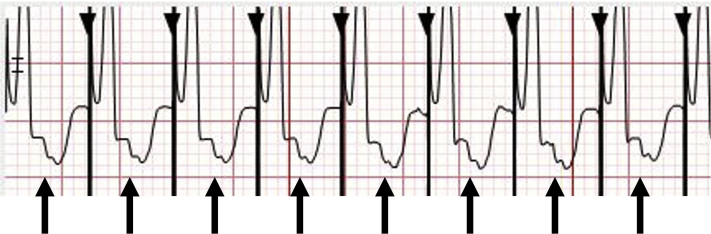 Figure 12