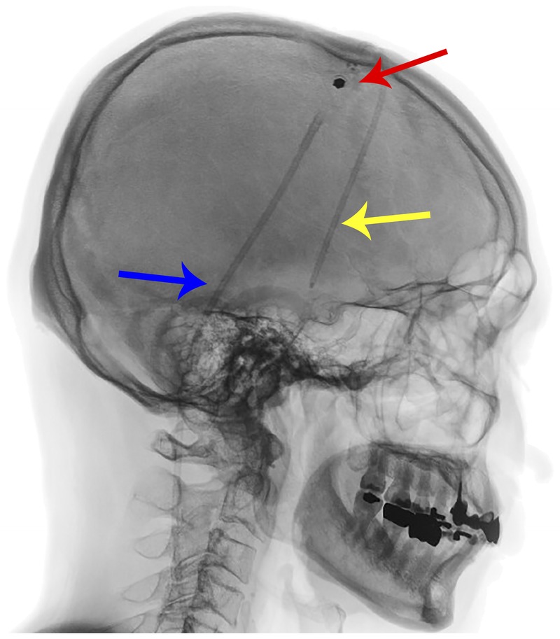 Figure 10-3