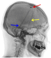 Figure 10-3